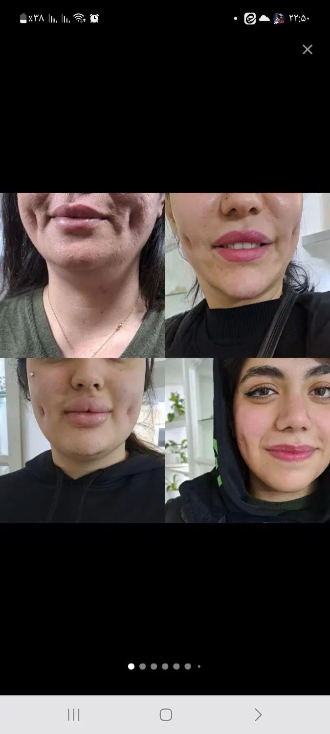 مدل پیرسینگ میکرو.چالگونه.نگین دندان توسط متخصص|خدمات آرایشگری و زیبایی|مشهد, شهید فرامرز عباسی|دیوار