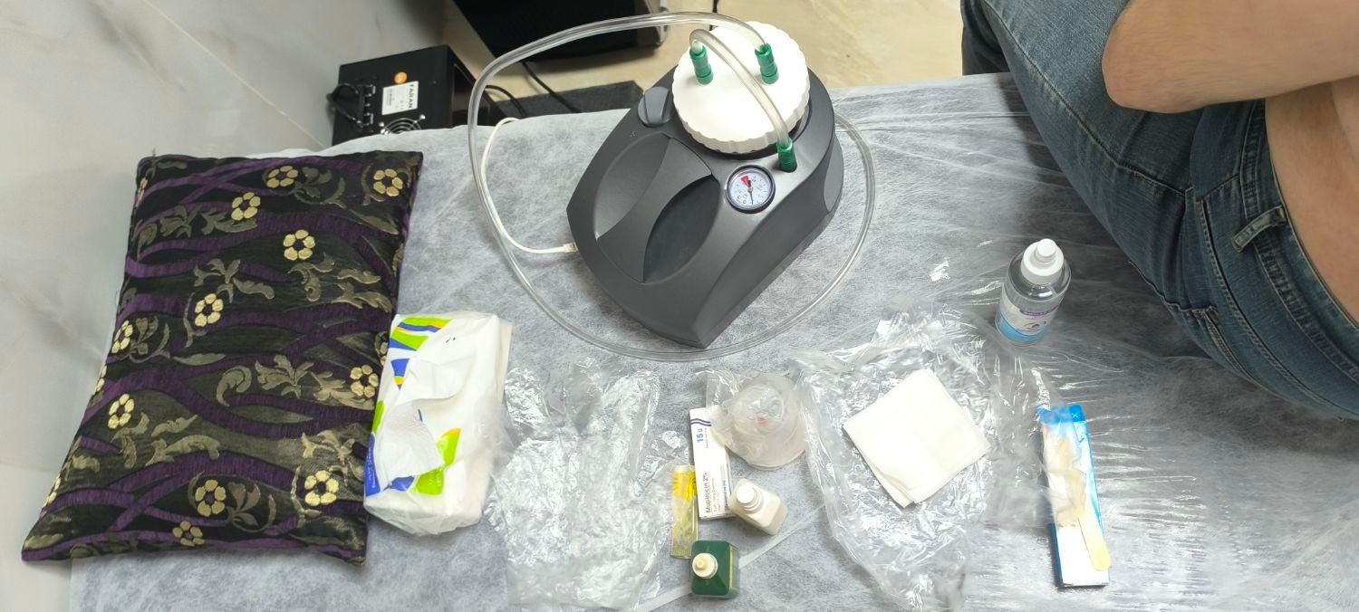 حجامت تخصصی توسط کادر پزشکی در کلینیک|خدمات آرایشگری و زیبایی|تبریز, |دیوار