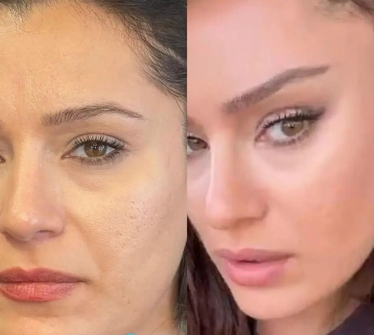 جراحی بینی لیفت بوتاکس نخ مزو فیلر فشیال|خدمات آرایشگری و زیبایی|شاهین‌شهر, عطار|دیوار