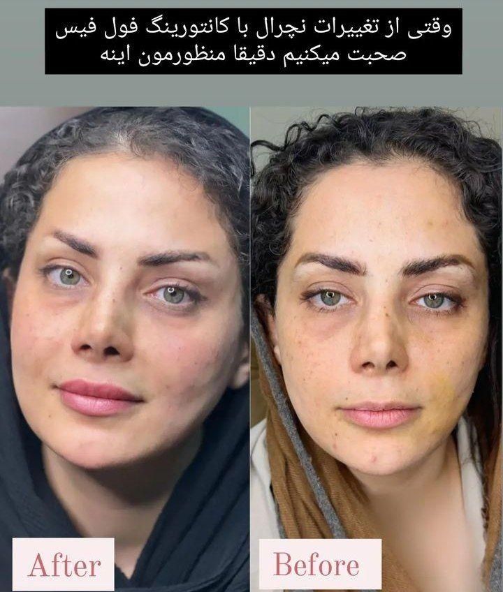 بوتاکس ژل آنزیم نخ لاغری بوتاکس 650 ژل اودری 450|خدمات آرایشگری و زیبایی|قم, هفت تیر|دیوار