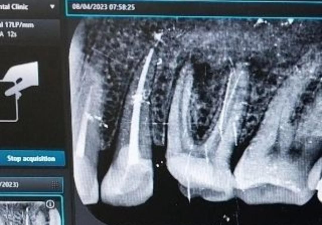 جشنواره دندانپزشکی دکتر یگانه میدان سرقنات|خدمات آرایشگری و زیبایی|قدس, شهرقدس|دیوار