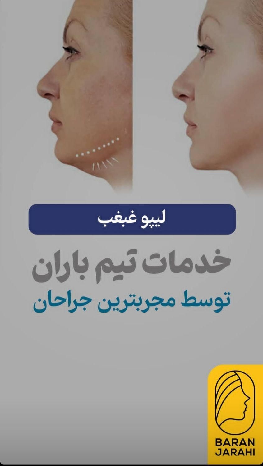 لیپوماتیک و ابدو مینو پلاستی ۳۶۰. مامو پلاستی|خدمات آرایشگری و زیبایی|شیراز, فرهنگ شهر|دیوار