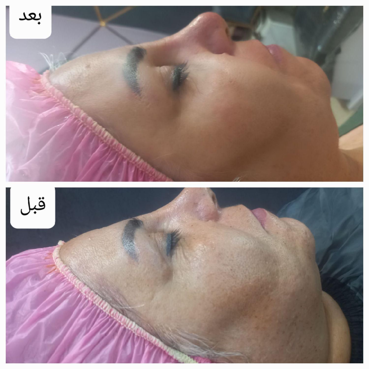 فشیال و خدمات جوانسازی ارغوان بر پایه علم نوین|خدمات آرایشگری و زیبایی|نیشابور, محله میدان باغات|دیوار