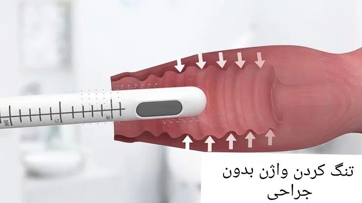 هایفو صورت|خدمات آرایشگری و زیبایی|کرج, مهرویلا شمالی|دیوار