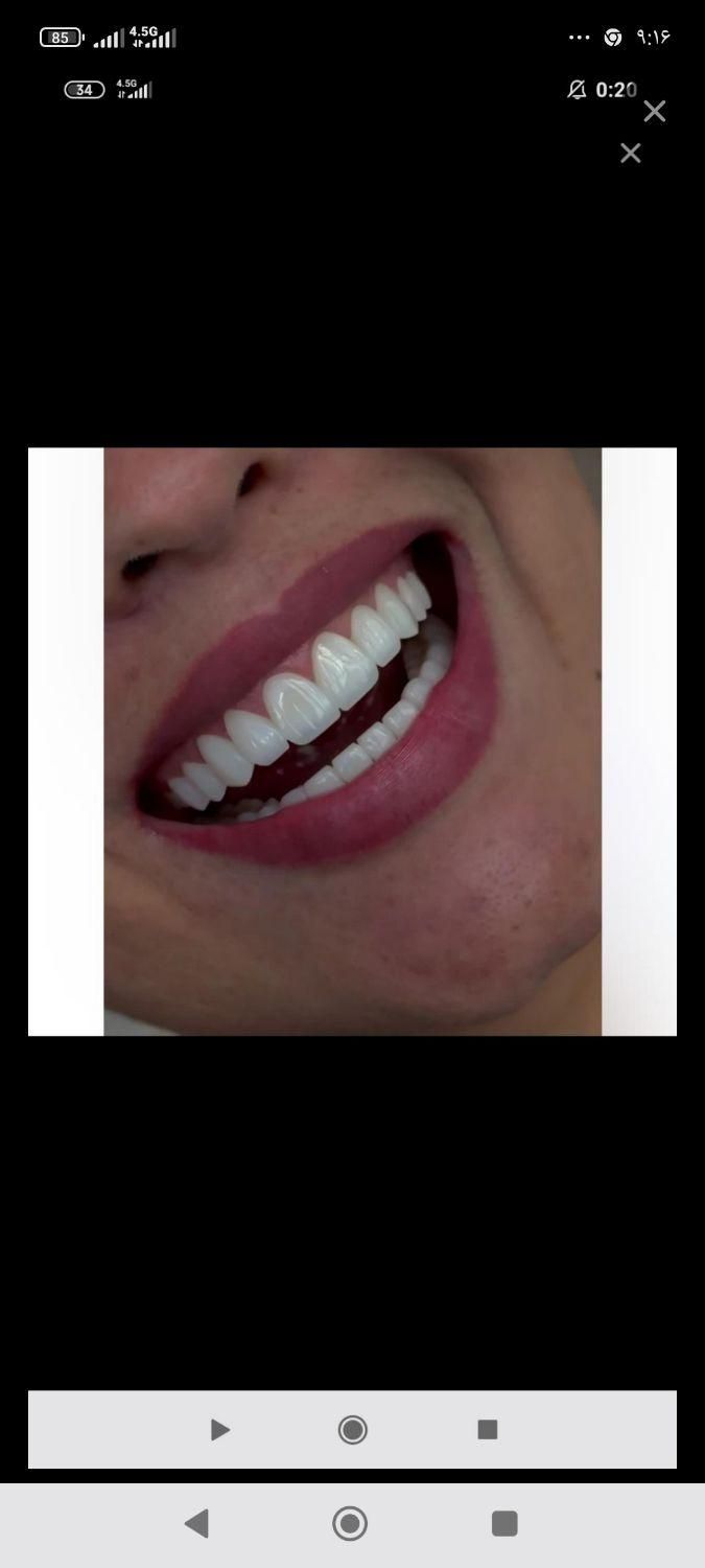 کلینیک تخصصی دندانپزشکی|خدمات آرایشگری و زیبایی|کرمانشاه, |دیوار