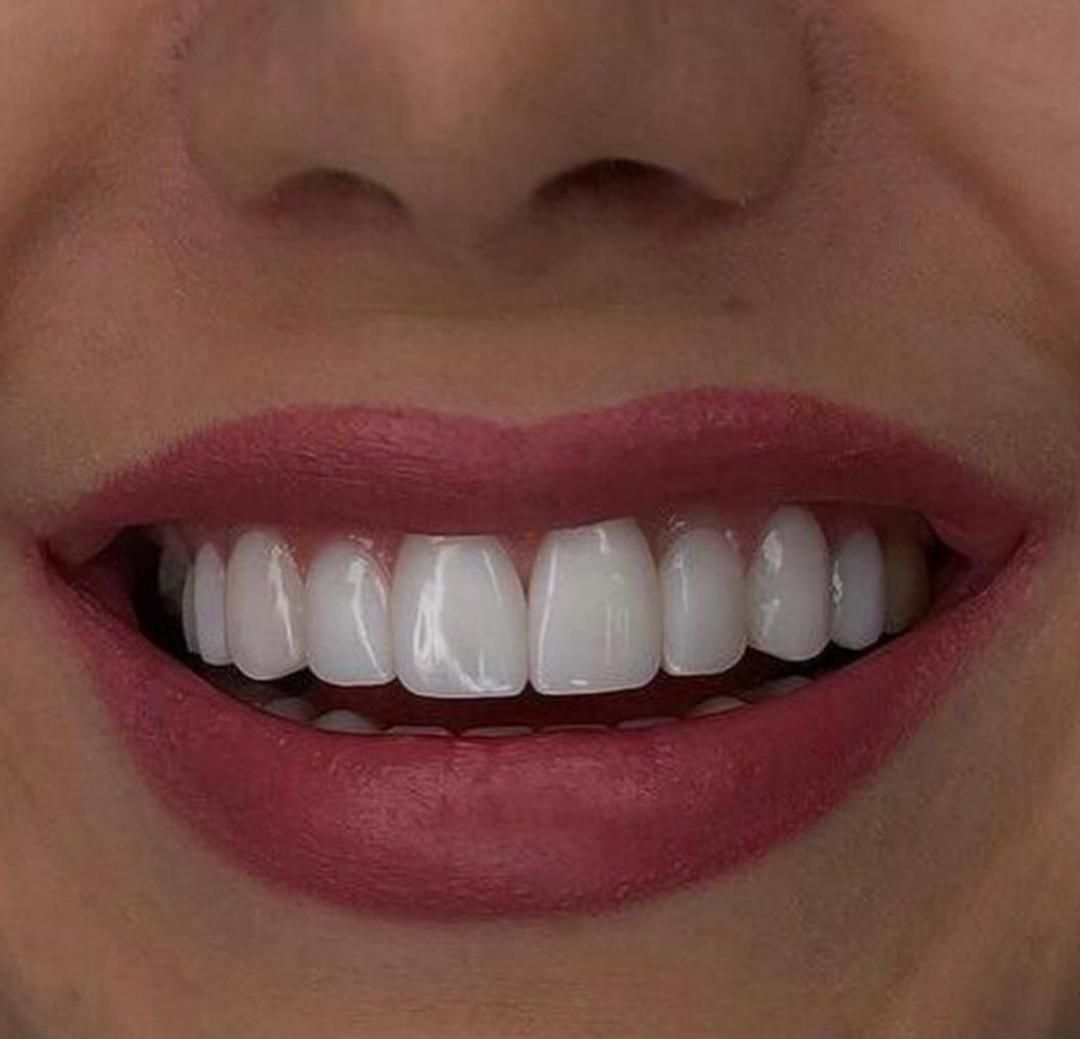 دندانپزشکی|خدمات آرایشگری و زیبایی|قم, عمار یاسر|دیوار