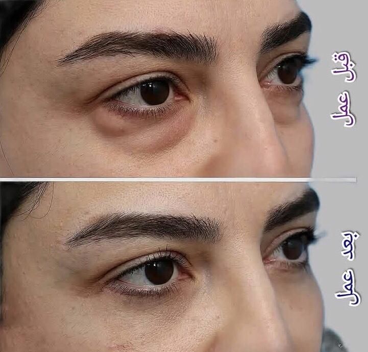 جراحی و زیبایی صورت و بدن، مزو، بوتاکس، چربی، فیلر|خدمات آرایشگری و زیبایی|کرمانشاه, |دیوار