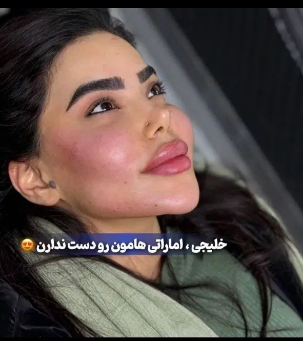 تزریق واموزش ژل بوتاکس مزوتراپی لیفت نخ...|خدمات آرایشگری و زیبایی|کرمانشاه, |دیوار