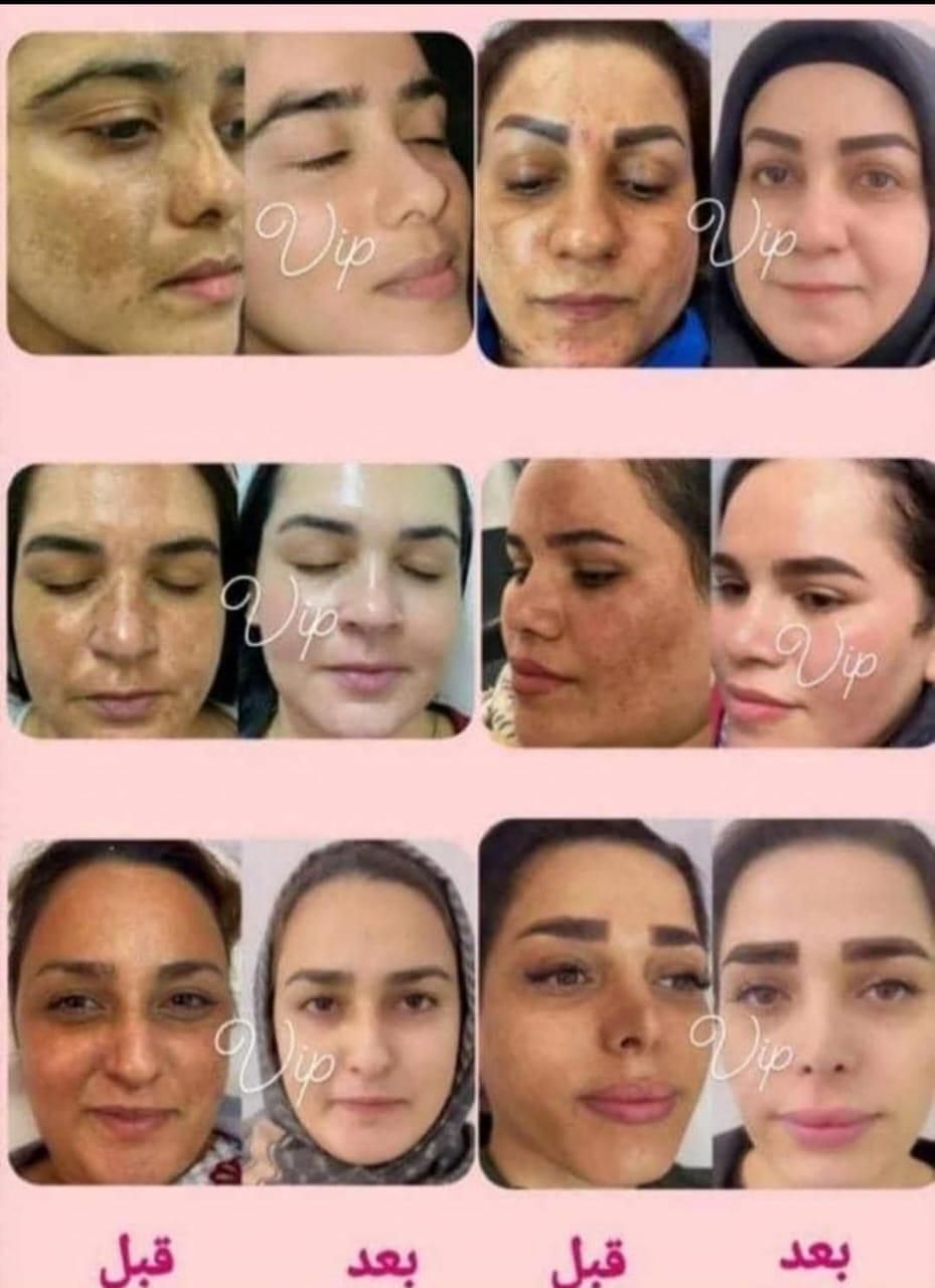تنهاکرم وی ای پی اصل دراستان کهگلویه وبویراحمد|آرایشی، بهداشتی، درمانی|دهدشت, |دیوار