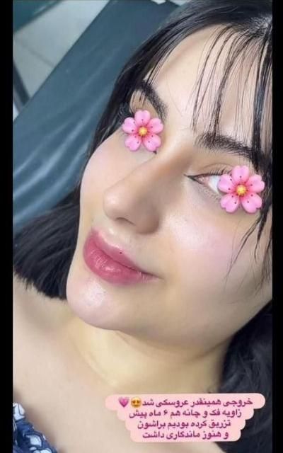 جشنواره ژل و بوتاکس|خدمات آرایشگری و زیبایی|تهران, هفت حوض|دیوار