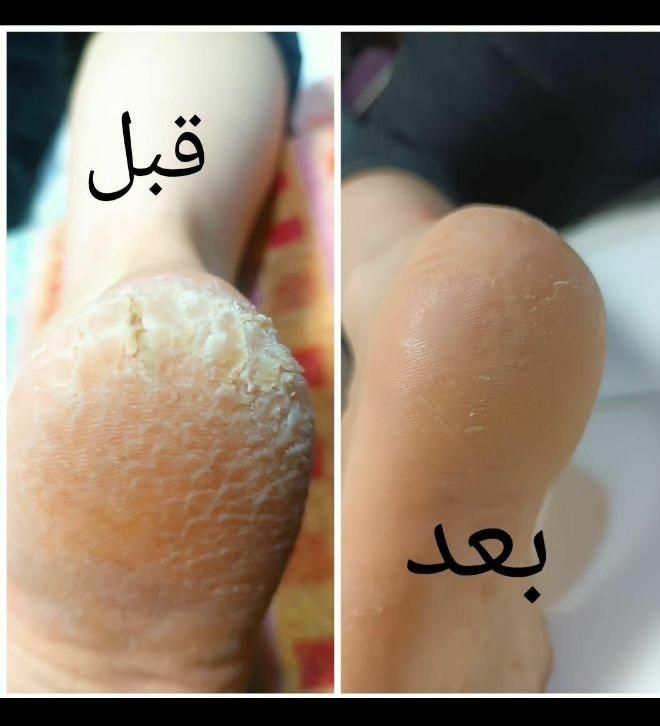 آموزش و خدمات پرسینگ و پدیکورتراپی تخفیف ۸۰ درصدی|خدمات آرایشگری و زیبایی|کرج, باغستان|دیوار