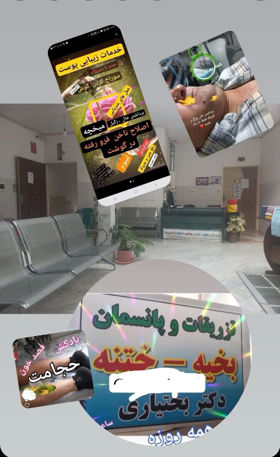 برداستن خال ، ختنه، زگیل،میخچه، جراحی سرپایی درمطب|خدمات آرایشگری و زیبایی|تویسرکان, |دیوار