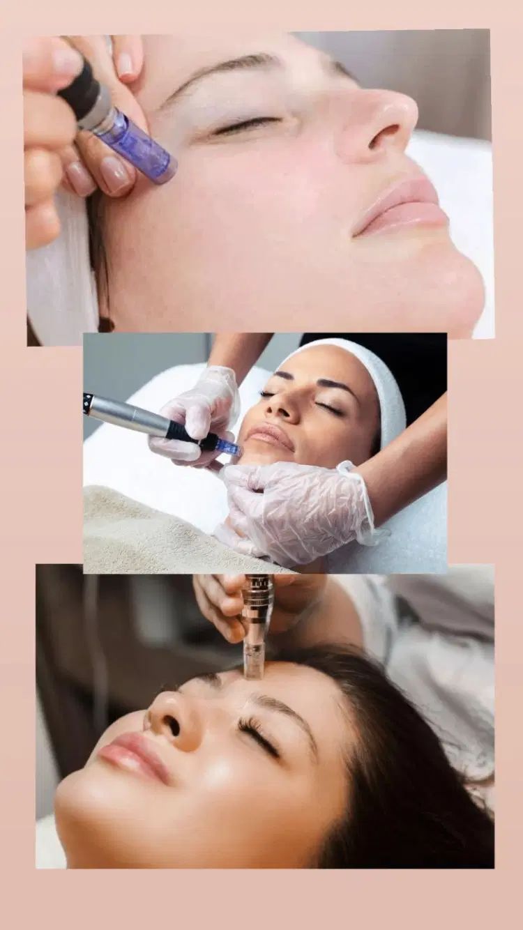مدل جهت پاکسازی و فیشال و اسکراب اسکالپ پوست و مو|خدمات آرایشگری و زیبایی|مشهد, بهشت|دیوار