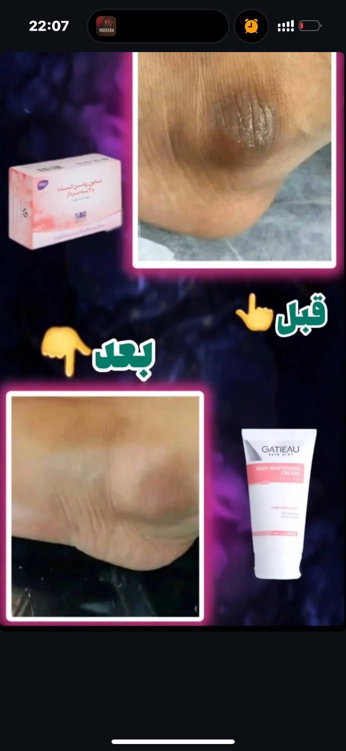 پکیج روشن کننده بدن گاتیو تضمینی (اصلی)|آرایشی، بهداشتی، درمانی|مشهد, جنت|دیوار