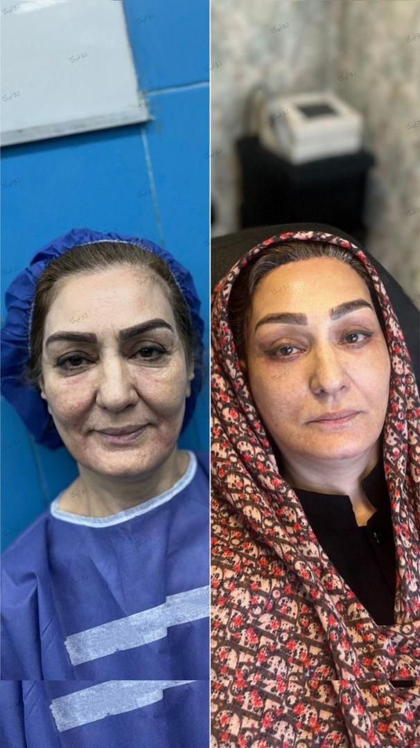 فروش ژل بوتاکس نخ و لوازم بهداشتی کلینیک  زیبایی|خدمات آرایشگری و زیبایی|تهران, قیطریه|دیوار
