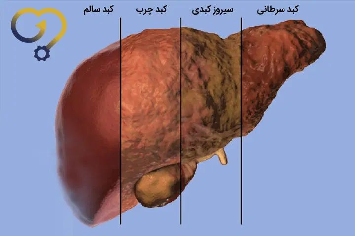 کبد چرب|فعالیت داوطلبانه|تهران, الهیه|دیوار