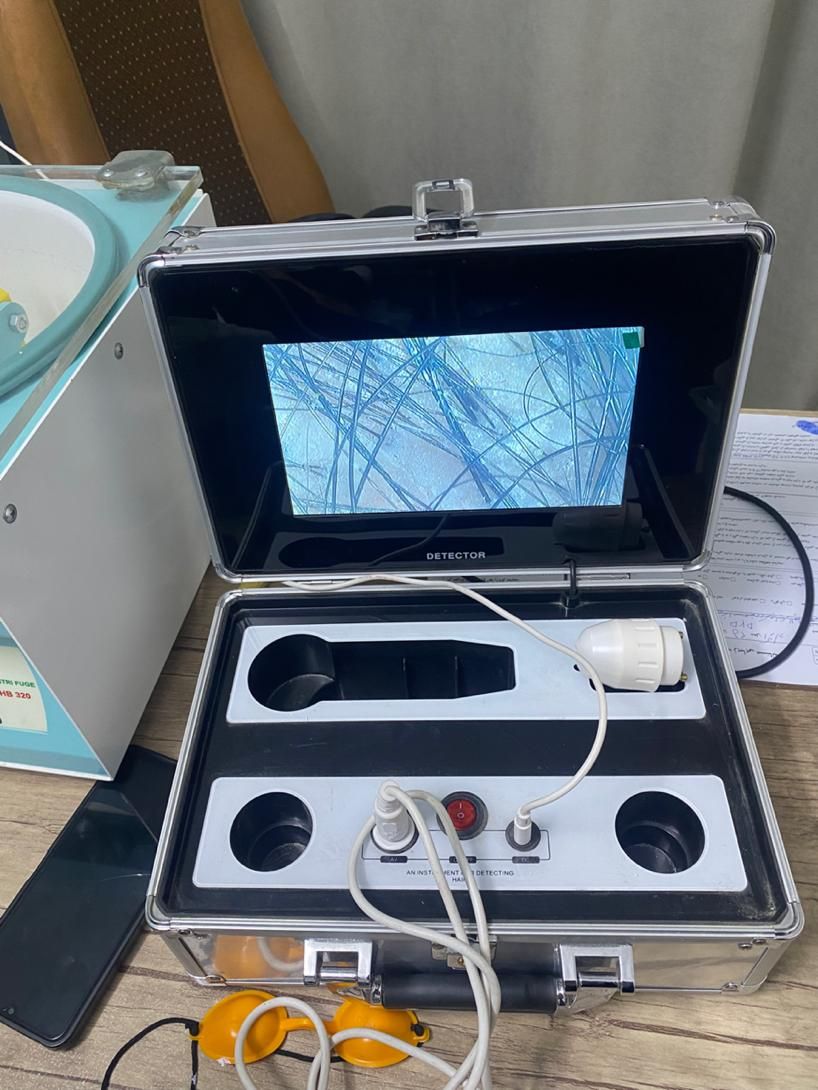 جشنواره روشن کردن زیربغل و زیر بغل و پاک کردن تاتو|خدمات آرایشگری و زیبایی|اسلامشهر, شهرک قائمیه|دیوار