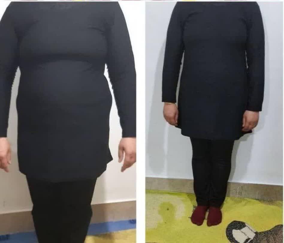 معجزه لاغری|آرایشی، بهداشتی، درمانی|قم, انسجام|دیوار