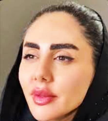 تزریق ژل و بوتاکس و فیلر بادی باتخفیف توسط پزشک|خدمات آرایشگری و زیبایی|شیراز, کلاهدوز|دیوار
