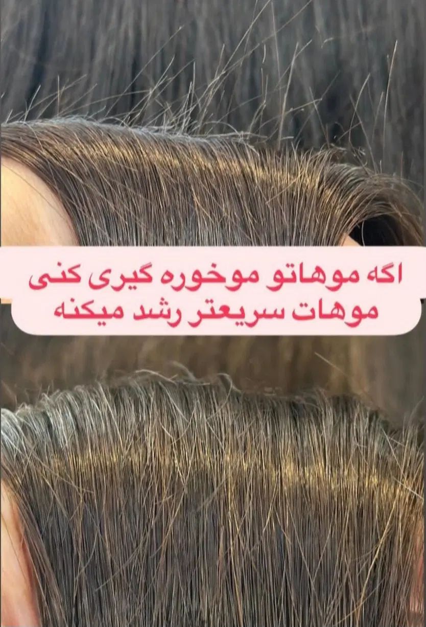موخوره گیری و پروتئین تراپی با پکیج الماس|خدمات آرایشگری و زیبایی|بومهن, |دیوار