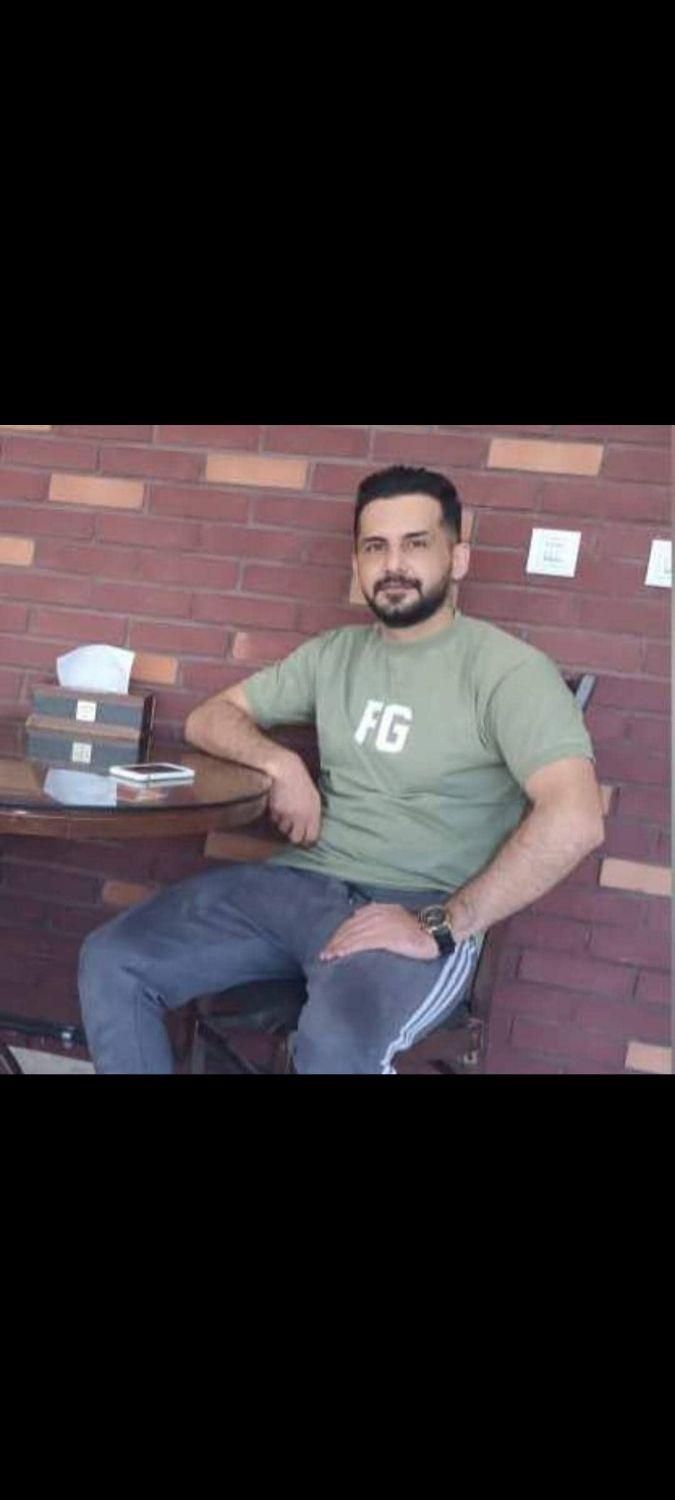 کاشت مو وابروی تخصصی فقط با ۱۳ میلیون تومان|خدمات آرایشگری و زیبایی|تهران, نیلوفر|دیوار