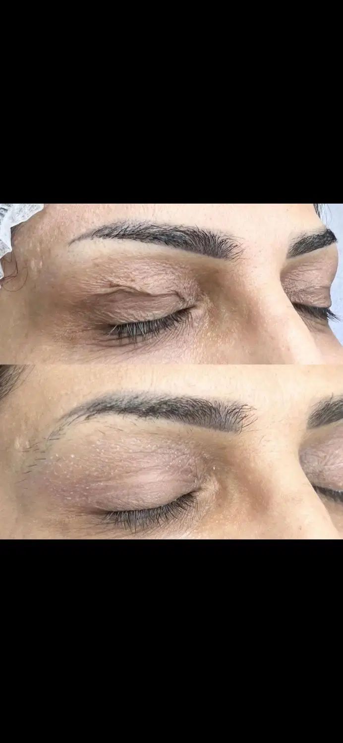 لیفت و جوانسازی پلک بدون جراحی با تخفیف ۵۰ درصد|خدمات آرایشگری و زیبایی|اصفهان, مرداویج|دیوار