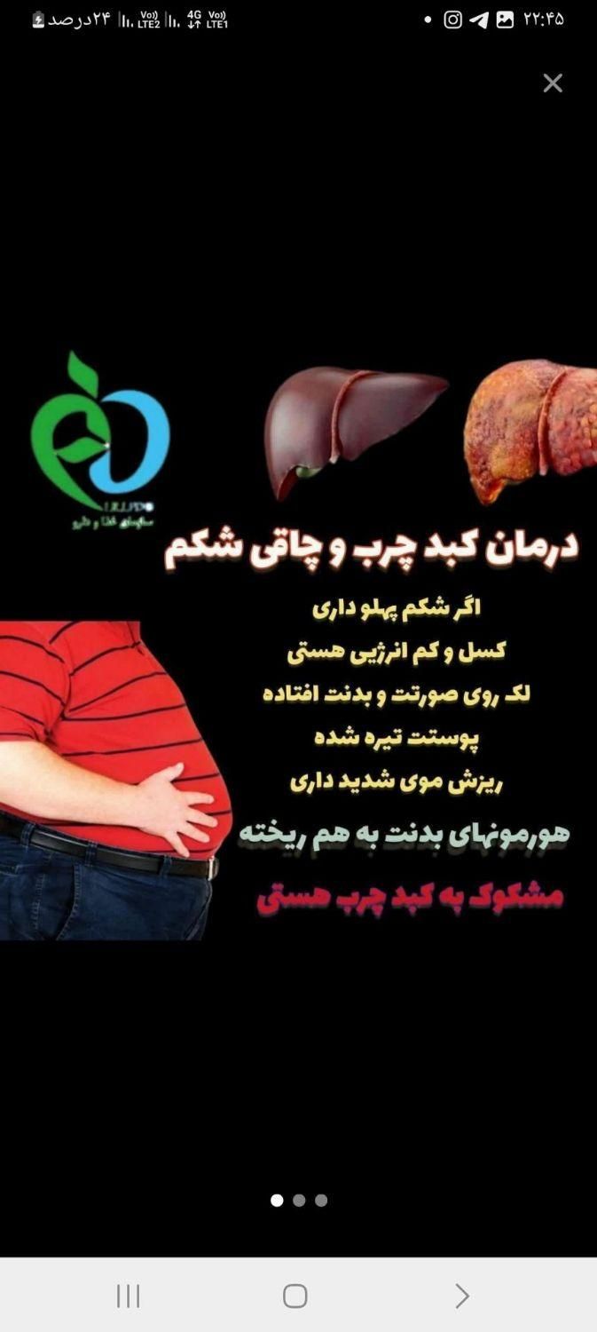 کبدچرب تو با اصلاح مزاج درمان کن|خدمات آرایشگری و زیبایی|گنبد کاووس, |دیوار