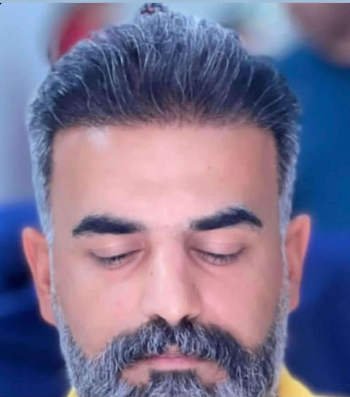 کاشت مو ابرو ریش بدون جراحی ضمانتنامه مادام العمر|خدمات آرایشگری و زیبایی|تهران, الهیه|دیوار