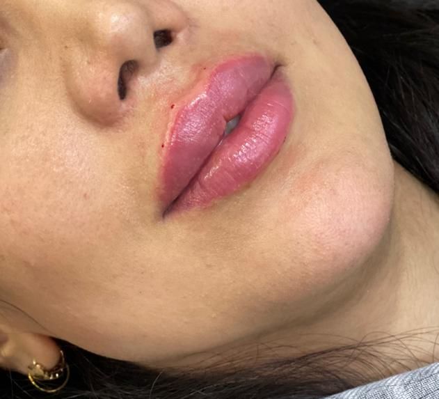 ژل لب،ژل باسن،بوتاکس هایفو نخ،مزو،زاویه سازی صورت|خدمات آرایشگری و زیبایی|شاهین‌شهر, فردوسی|دیوار