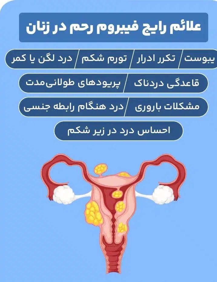 درمان کیست و فیبر م و مشکلات بانوان و نازایی|آرایشی، بهداشتی، درمانی|گنبد کاووس, |دیوار