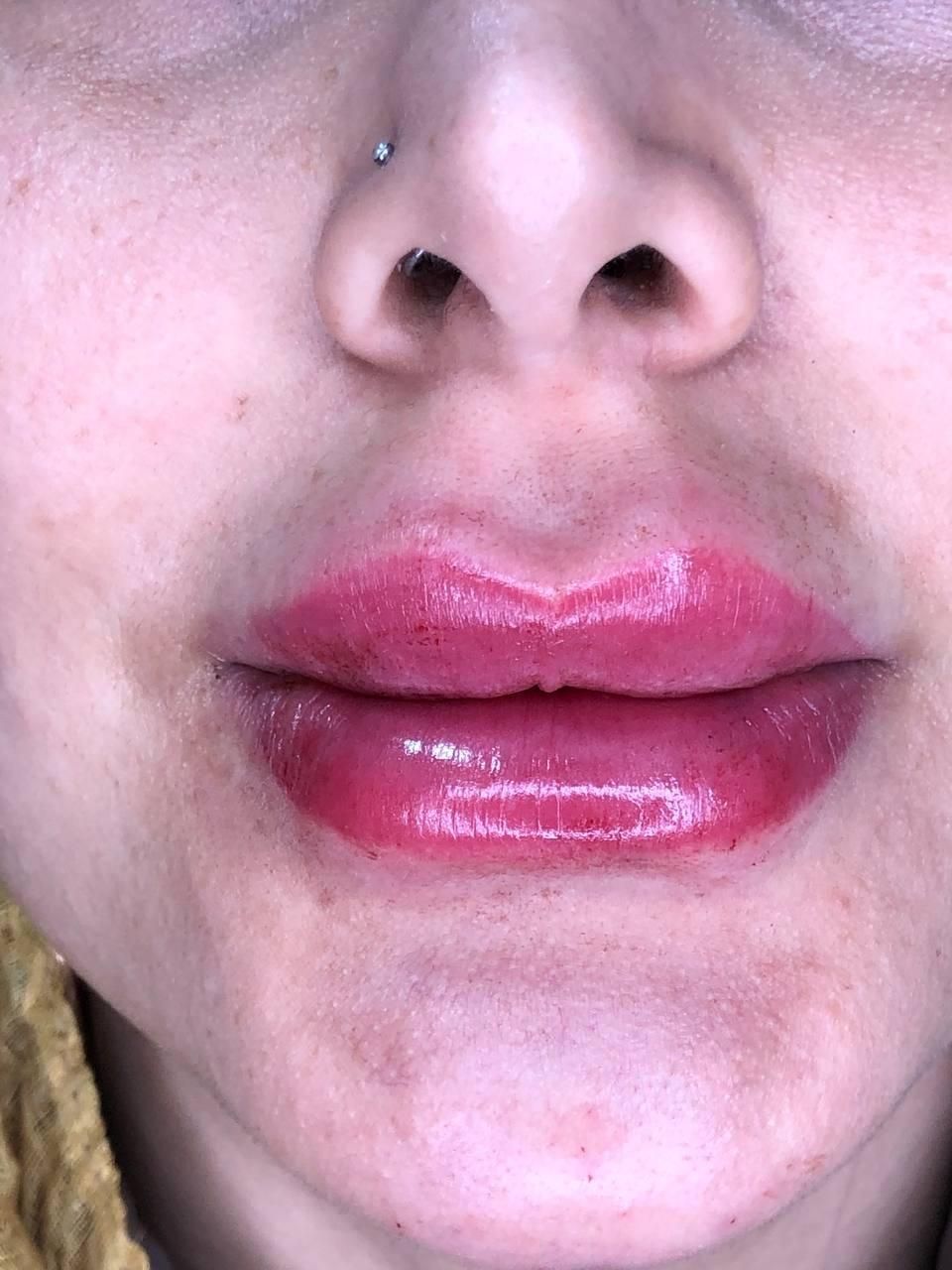 خدمات ژل و بوتاکس|خدمات آرایشگری و زیبایی|ساری, |دیوار