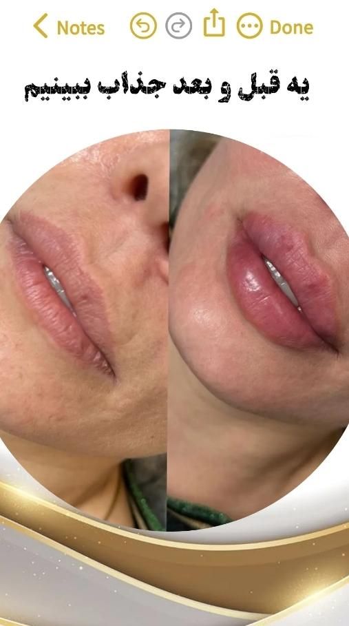 پاکسازی پوست ، ژل و بوتاکس در کلینیک زیبایی|خدمات آرایشگری و زیبایی|اهواز, پادادشهر|دیوار