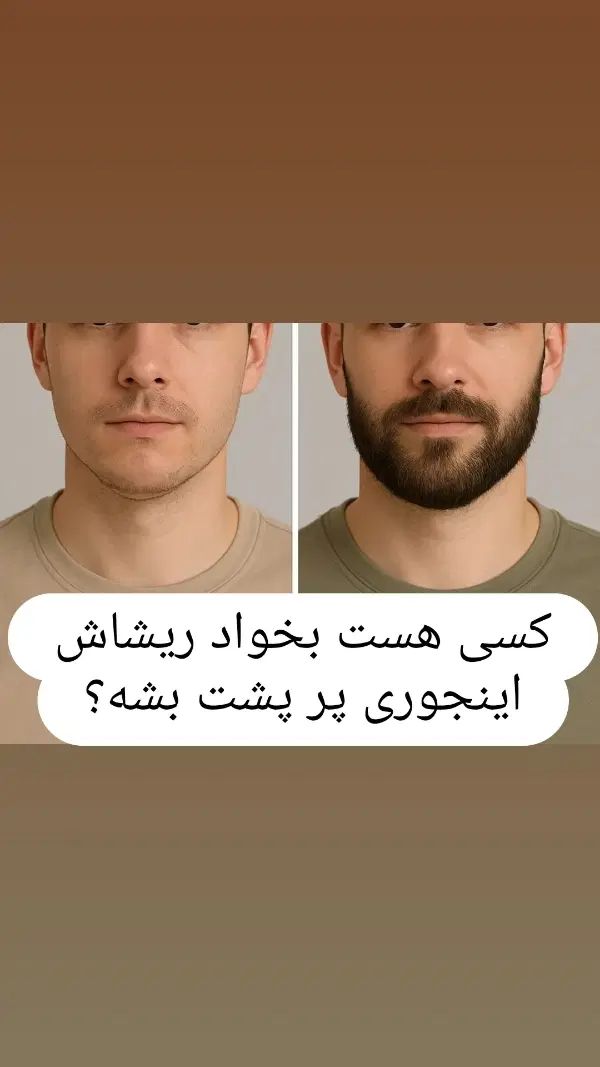 محلول پرپشت کننده و تقویت کننده ریش مژه و ابرو|آرایشی، بهداشتی، درمانی|پیرانشهر, |دیوار