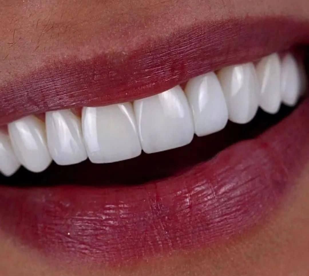 دندانپزشکی بدون پیش پرداخت عصب کشی . کامپوزیت و...|خدمات آرایشگری و زیبایی|قم, عمار یاسر|دیوار