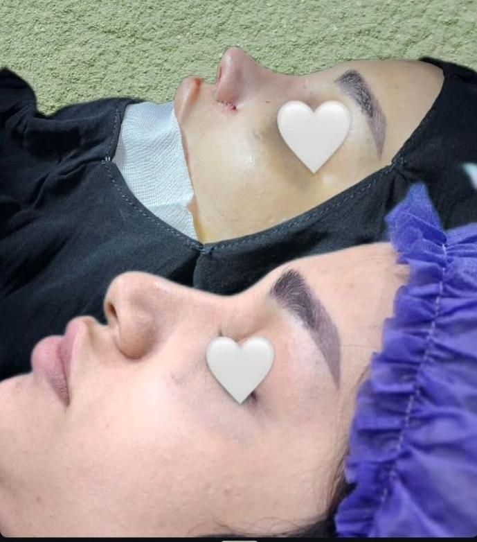 عمل های زیبایی توسط پزشک متخصص با مناسبترین قیمت|خدمات آرایشگری و زیبایی|اهواز, کیانپارس |دیوار