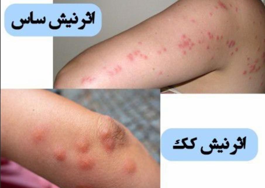 سمپاشی صدردصد‌تضمینی‌سم پاشی‌سوسک‌وساس و...|خدمات نظافت|تهران, آذری|دیوار