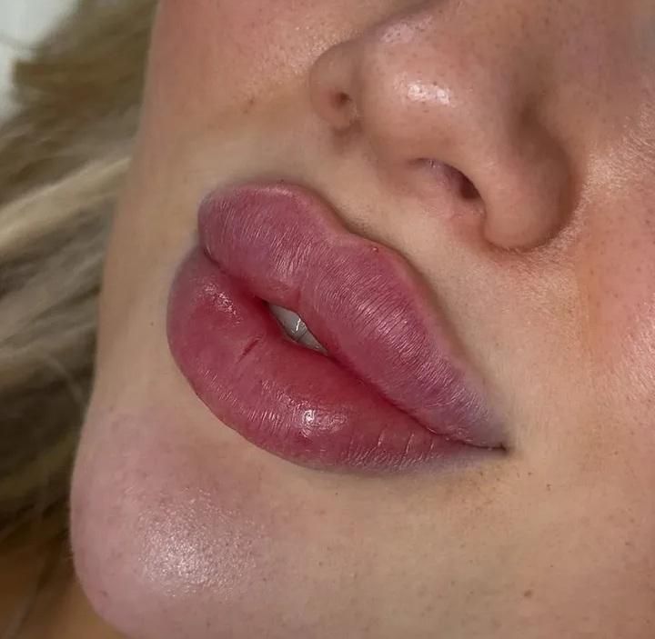 آموزش تزریق ژل و بوتاکس|خدمات آرایشگری و زیبایی|یاسوج, |دیوار