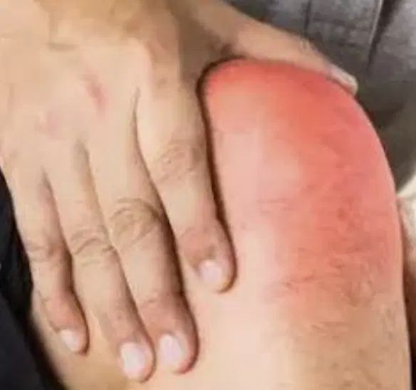 درمان دردهای رماتیسم و آرتروزمفصل|آرایشی، بهداشتی، درمانی|کرج, گوهردشت|دیوار