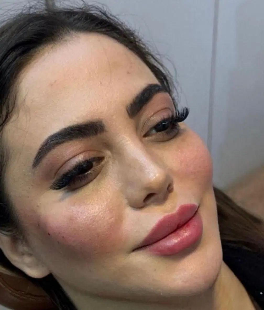 خدمات ژل بوتاکس مزو فیلر انزیم بوتاکس|خدمات آرایشگری و زیبایی|تهران, تهرانسر مرکزی|دیوار