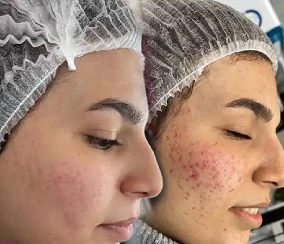 پاکسازی پوست صورت تخصصی (فیشیال vip)|خدمات آرایشگری و زیبایی|سنندج, |دیوار