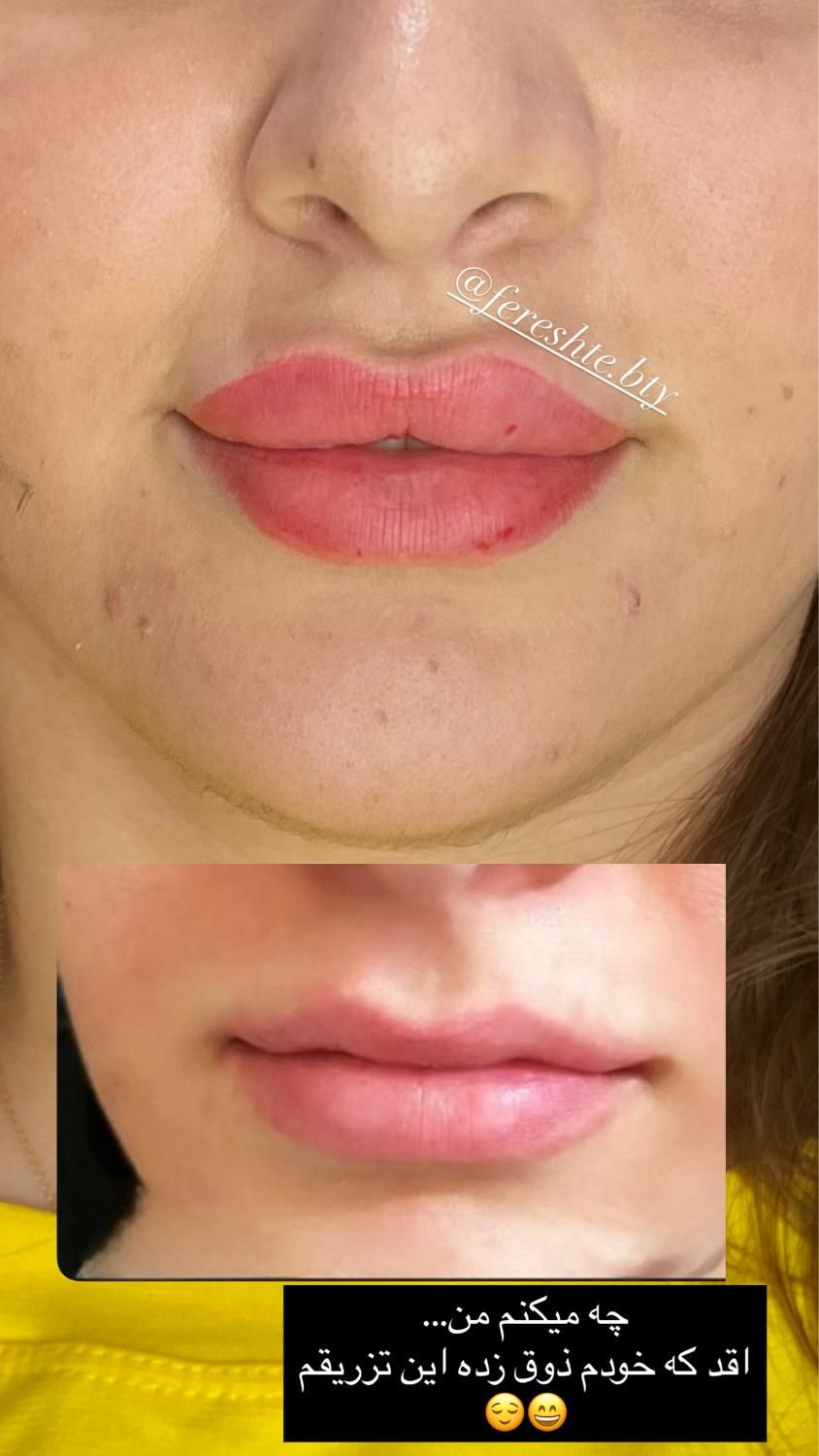 لیزر، ژل،بوتاکس،خال برداری و الکترولیز،لیبیاپلاستی|خدمات آرایشگری و زیبایی|شیراز, پانصد دستگاه ارتش|دیوار