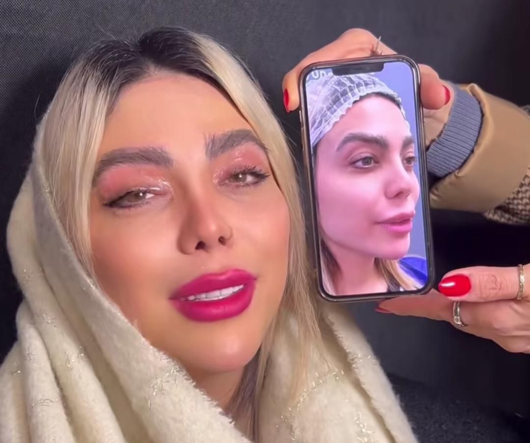 بلفاروپلاستی پلک وسانترال لب 9.360|خدمات آرایشگری و زیبایی|اصفهان, شهشهان|دیوار