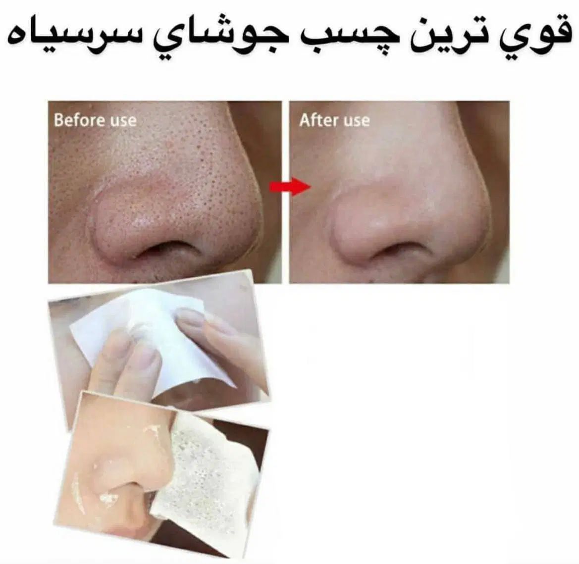 چسب بینی لانبنا اورجینال ضمانتی رزماری آرگان اصلی|آرایشی، بهداشتی، درمانی|مشهد, طلاب|دیوار