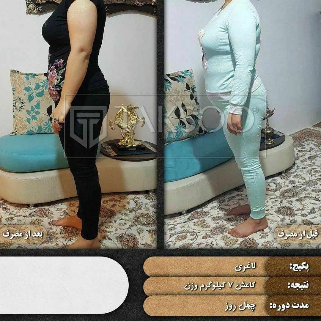 چاقی لاغری پوست مو کبدچرب فشارخون نازایی|آرایشی، بهداشتی، درمانی|مشهد, سناباد|دیوار