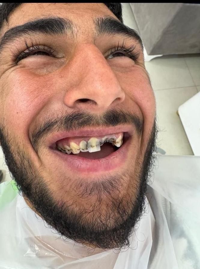 کامپوزیت تا هفته آینده دوفک 24 ت کاریزما آلمان|خدمات آرایشگری و زیبایی|مشهد, هنرستان|دیوار