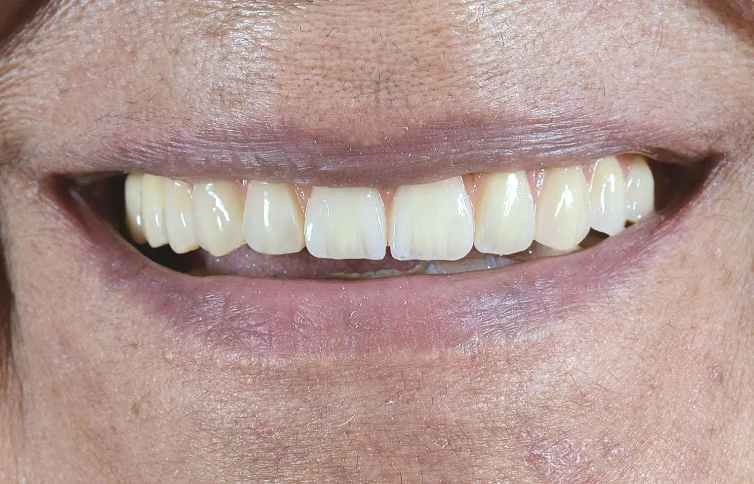 مطب تخصصی دندانپزشکی|خدمات آرایشگری و زیبایی|تهران, فرمانیه|دیوار