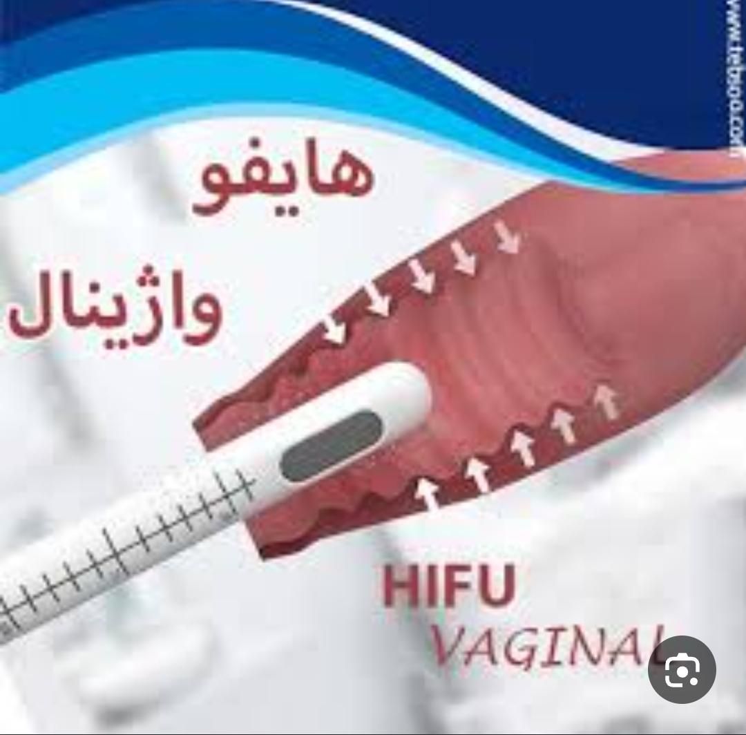 هایفو،قطعی ترین روش تنگ کردن واژن ولیفت صورت،|خدمات آرایشگری و زیبایی|مشهد, کوی المهدی|دیوار