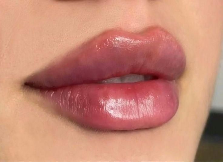 تزریق ژل و بوتاکس توسط پزشک|خدمات آرایشگری و زیبایی|تهران, صادقیه|دیوار
