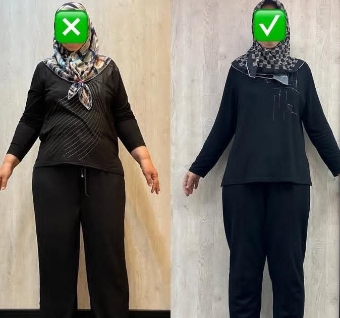 امبدینگ لاغری (ساختمان پزشکان رفاه پاکدشت)|خدمات آرایشگری و زیبایی|پاکدشت, پاکدشت (مامازند)|دیوار