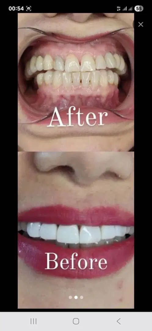 دندانپزشکی با بهترین متریال و مواد درجه یک|خدمات آرایشگری و زیبایی|کرمانشاه, |دیوار